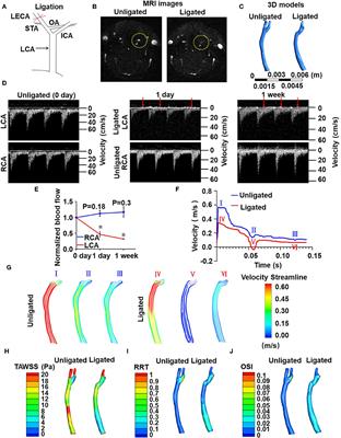 VAMP3 and SNAP23 as Potential Targets for Preventing the Disturbed Flow-Accelerated Thrombus Formation